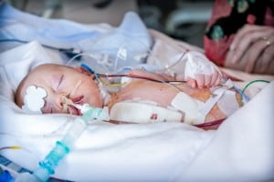 Statute of Limitations for Late-Emerging Birth Injuries in Tennessee